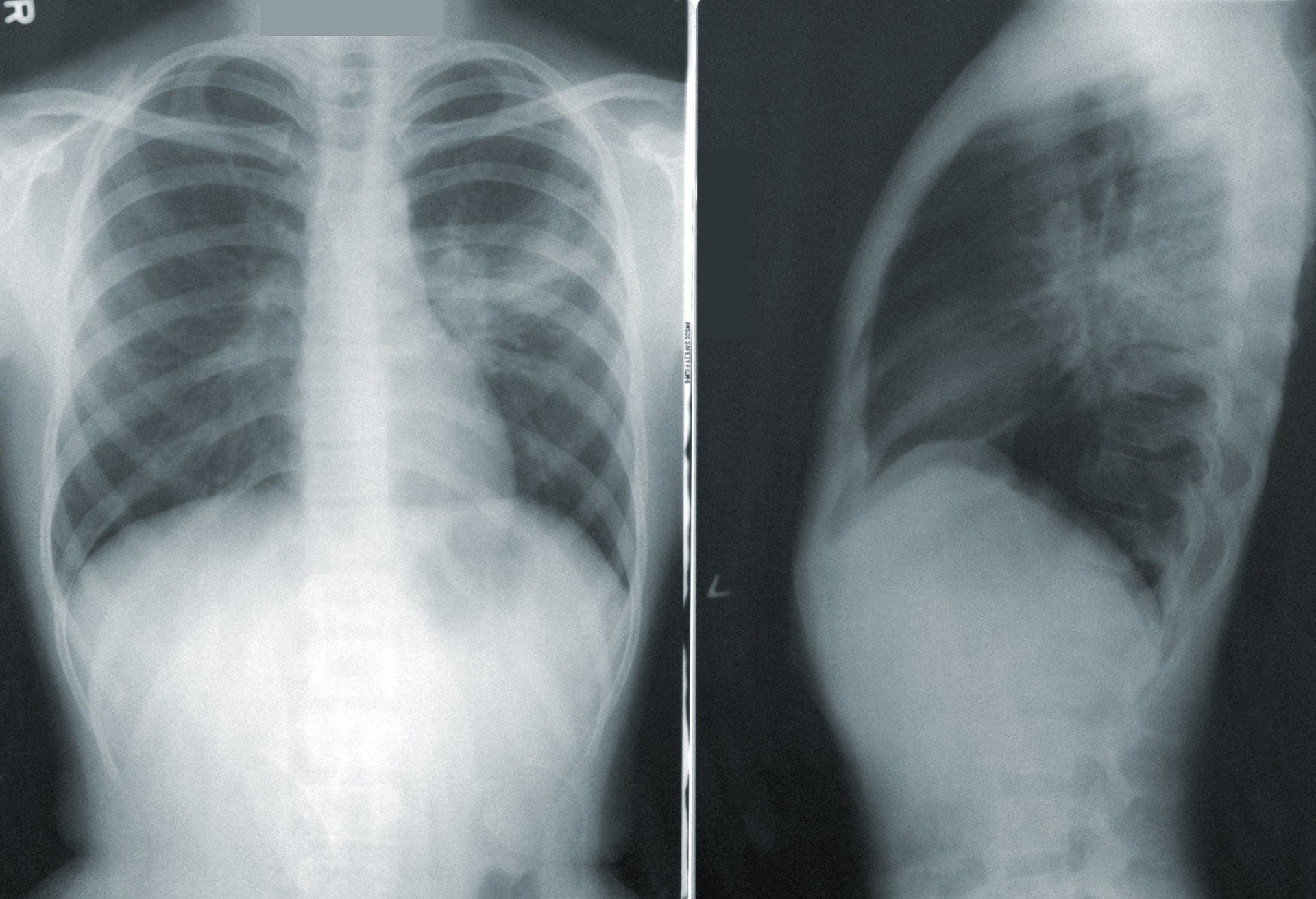 Machine learning means you can see like a radiologist -📸 CDC