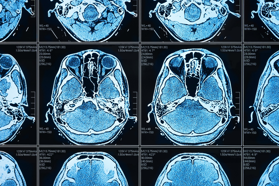 Federated Learning on medical images (source: Shutterstock)