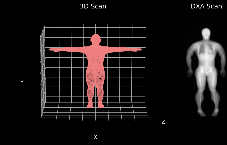 3D body surface scan point cloud and matching dual energy X-ray absorptiometry (DXA) scan (Image by Author)