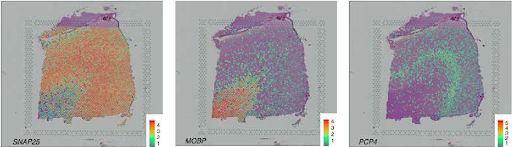 Unraveling Spatially Variable Genes: A Statistical Perspective on Spatial Transcriptomics